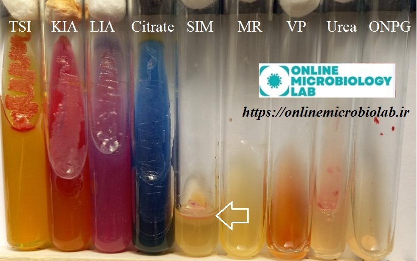 گالری سراشیا مارسسنس (Serratia marcescens) آزمایشگاه مجازی میکروب شناسی
