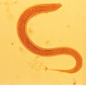 کرم های قلابدار (Hookworm) روده ای: چرخه زندگی و تشخیص - آزمایشگاه ...