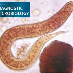 استرونژیلوئیدس استرکورالیس (Strongyloides stercoralis): چرخه زندگی و ...